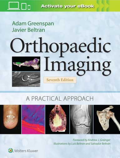 Image of - Orthopaedic Imaging A Practical Approach | 7th Edition | Hardcover