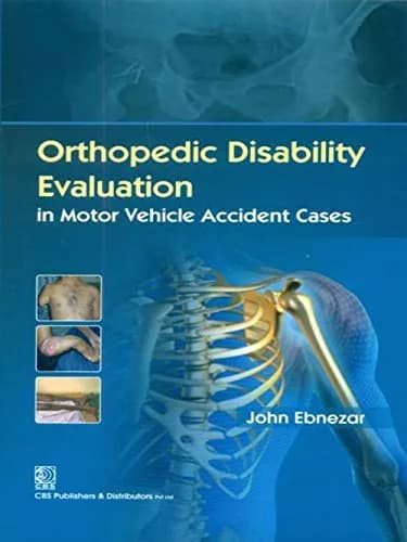 Image of - Orthopedic Disability Evaluation in Motor Vehicle Accident Cases