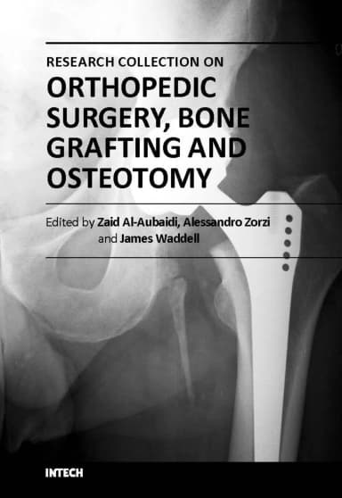 Image of - Orthopedic Surgery | Bone Grafting and Osteotomy | Hardcover