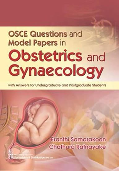 Image of - Osce Questions And Model Papers In Obstetrics And Gynaecology | Paperback
