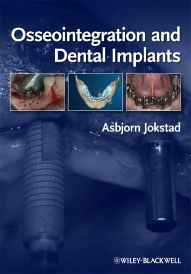 Image of - Osseointegration and Dental Implants | Hardcover
