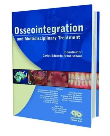 Image of - Osseointegration and Multidisciplinary Treatment | Hardcover
