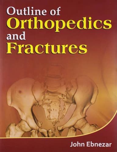 Image of - Outline of Orthopedics and Fractures | Paperback