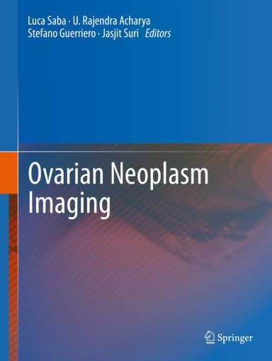 Image of - Ovarian Neoplasm Imaging | Hardcover