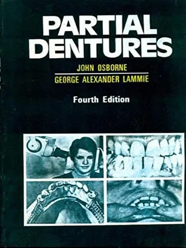 Image of - Partial Denture | 4th Edition