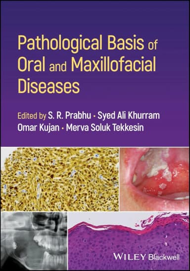 Image of - Pathological Basis Of Oral And Maxillofacial Diseases | Paperback