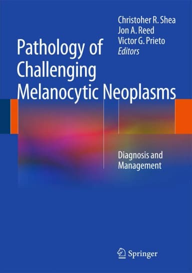 Image of - Pathology of Challenging Melanocytic Neoplasms | Hardcover