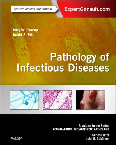 Image of - Pathology of Infectious Diseases | Hardcover