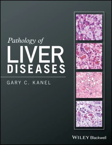 Image of - Pathology of Liver Diseases | Hardcover