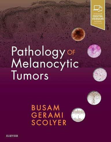 Image of - Pathology of Melanocytic Tumors | Hardcover