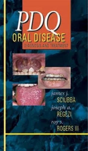 Image of - PDQ Oral Disease Diagnosis and Treatment With CD | Paperback