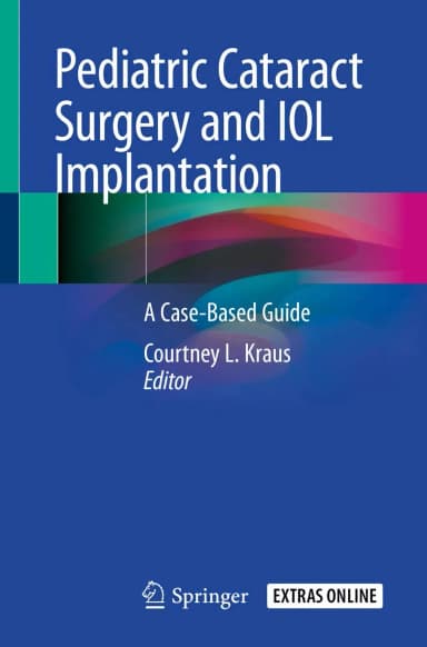 Image of - Pediatric Cataract Surgery And Iol Implantation A Case Based Guide | Paperback