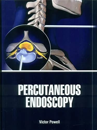 Image of - Percutaneous Endoscopy | Hardcover