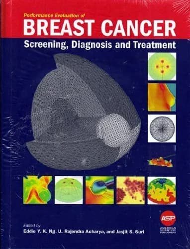 Image of - Performance Breast Cancer Screening Diagnosis And Treatment | Hardcover