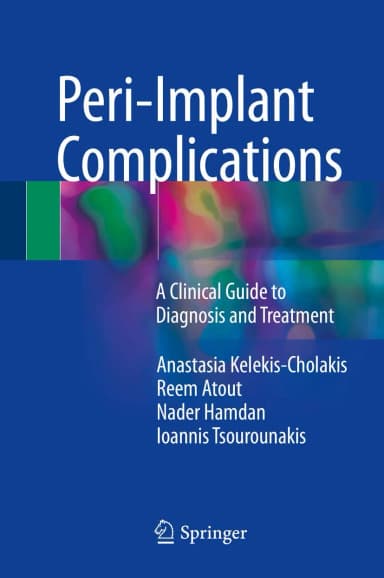 Image of - Peri-Implant Complications | Hardcover