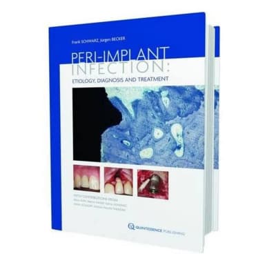 Image of - Peri-Implant Infection Etiology | Diagnosis and Treatment | Hardcover