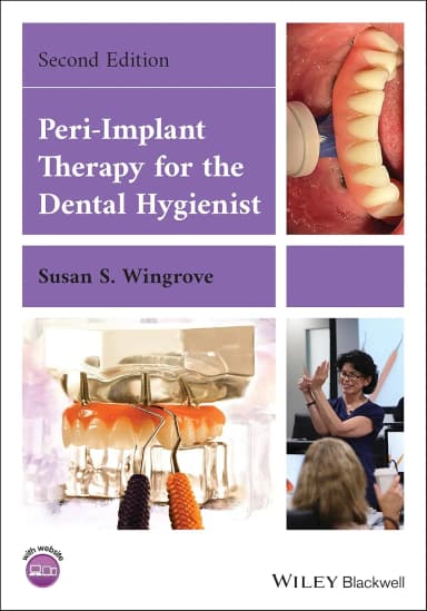 Image of - Peri Implant Therapy For The Dental Hygienist 2nd Edition | Paperback