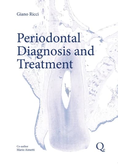 Image of - Periodontal Diagnosis and Therapy | Hardcover