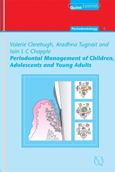 Image of - Periodontal Management of Children | Adolescents and Young Adults | Hardcover