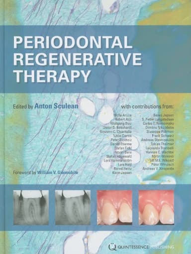 Image of - Periodontal Regenerative Therapy | Hardcover