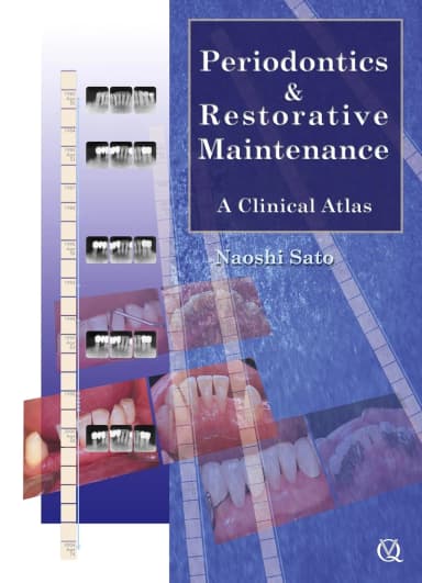 Image of - Periodontics and Restorative Maintenance A Clinical Atlas | Hardcover