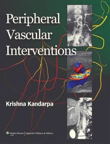 Image of - Peripheral Vascular Interventions | Hardcover