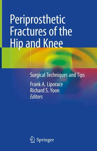 Image of - Periprosthetic Fractures of the Hip and Knee | Hardcover