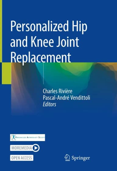 Image of - Personalized Hip And Knee Joint Replacement | Hardcover