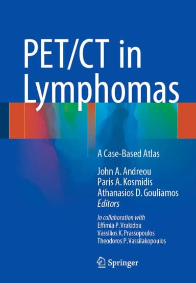Image of - PET/CT in Lymphomas | Hardcover