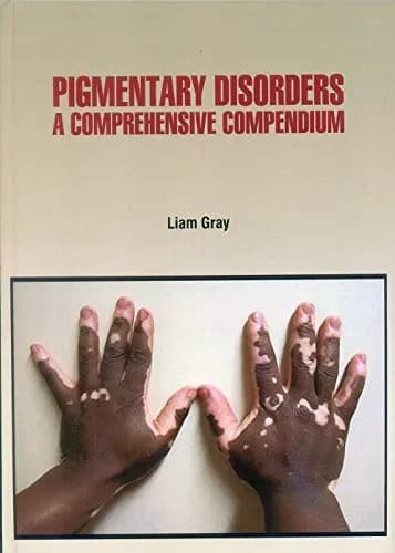 Image of - Pigmentary Disorders A Comprehensive Compendium | Hardcover