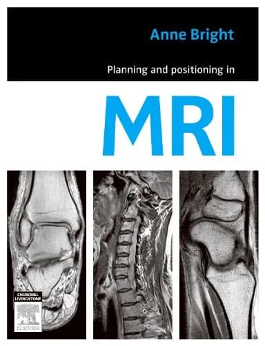Image of - Planning and Positioning in MRI | Paperback