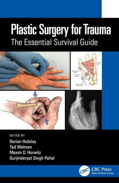 Image of - Plastic Surgery For Trauma The Essential Survival Guide | Paperback