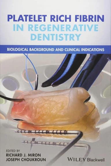Image of - Platelet Rich Fibrin in Regenerative Dentistry | Hardcover