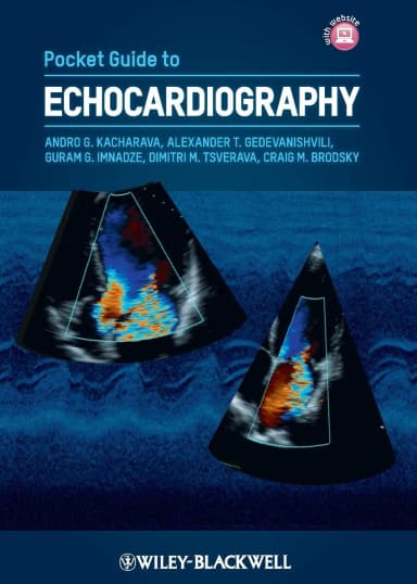 Image of - Pocket Guide to Echocardiography | Paperback