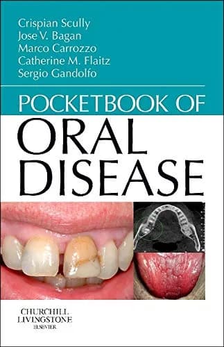 Image of - Pocketbook of Oral Disease | Paperback