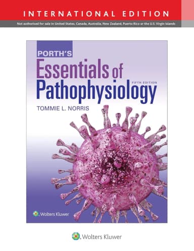 Image of - Porth's Essentials of Pathophysiology | 5th Edition | Paperback(IE)