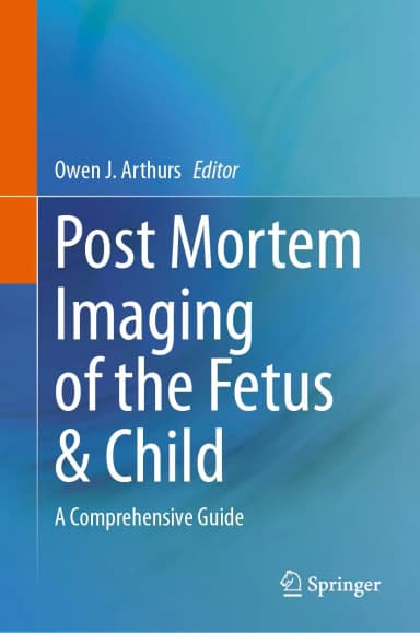 Image of - Post Mortem Imaging Of The Fetus And Child A Comprehensive Guide | Hardcover