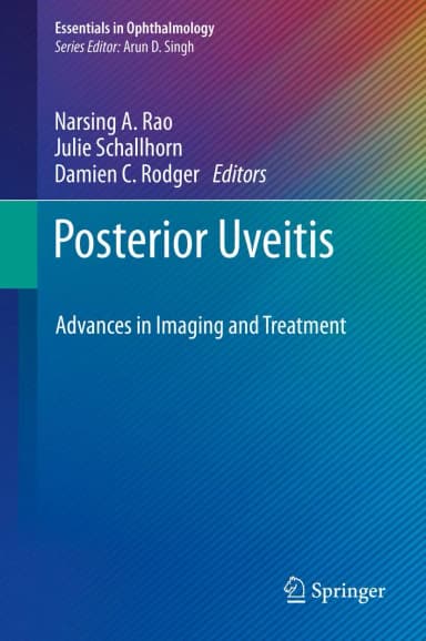 Image of - Posterior Uveitis Advances In Imaging and Treatment | Hardcover