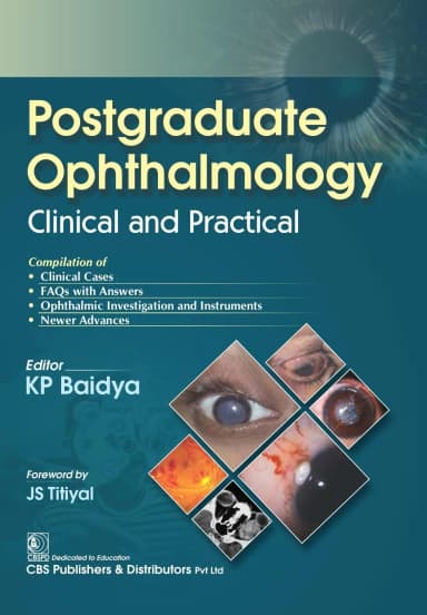 Image of - Postgraduate Ophthalmology Clinical And Practical | Paperback