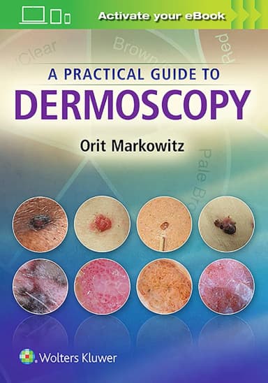Image of - A Practical Guide to Dermoscopy | Paperback