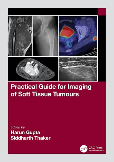 Image of - Practical Guide For Imaging Of Soft Tissue Tumours | Paperback