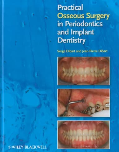 Image of - Practical Osseous Surgery in Periodontics and Implant Dentistry | Hardcover