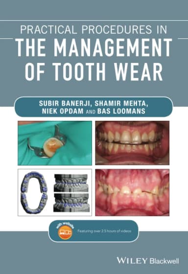 Image of - Practical Procedures In The Management Of Tooth Wear | Paperback