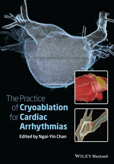 Image of - The Practice of Catheter Cryoablation for Cardiac Arrhythmias | Hardcover