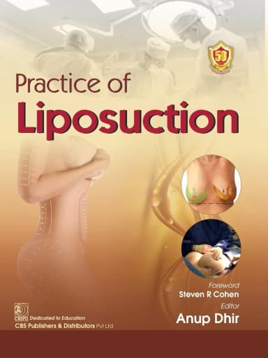 Image of - Practice of Liposuction