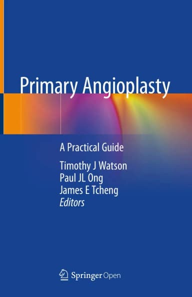 Image of - Primary Angioplasty | Hardcover