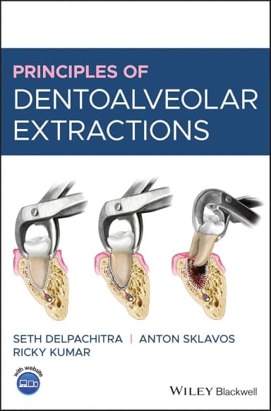 Image of - Principles Of Dentoalveolar Extractions | Hardcover
