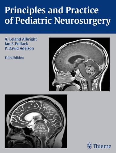 Image of - Principles and Practice of Pediatric Neurosurgery | Third Edition | Hardcover