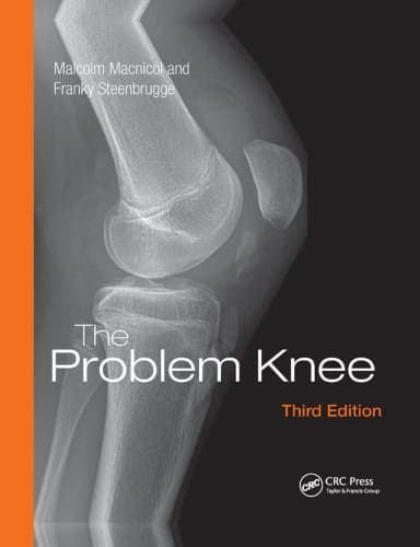 Image of - The Problem Knee | Third Edition | Paperback