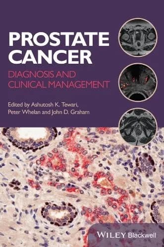 Image of - Prostate Cancer Diagnosis and Clinical Management | Paperback